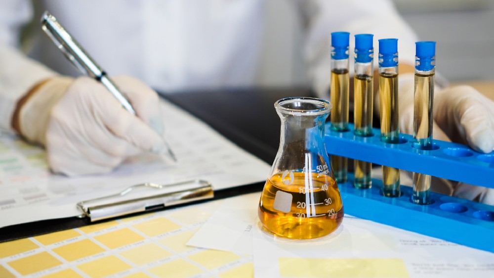 摄图网_329792637_医生将分析结果写成表格 用尿液测试管进行检查桌子液体诊所感染实验室医院治疗尿酸工作诊断(企业商用).jpg