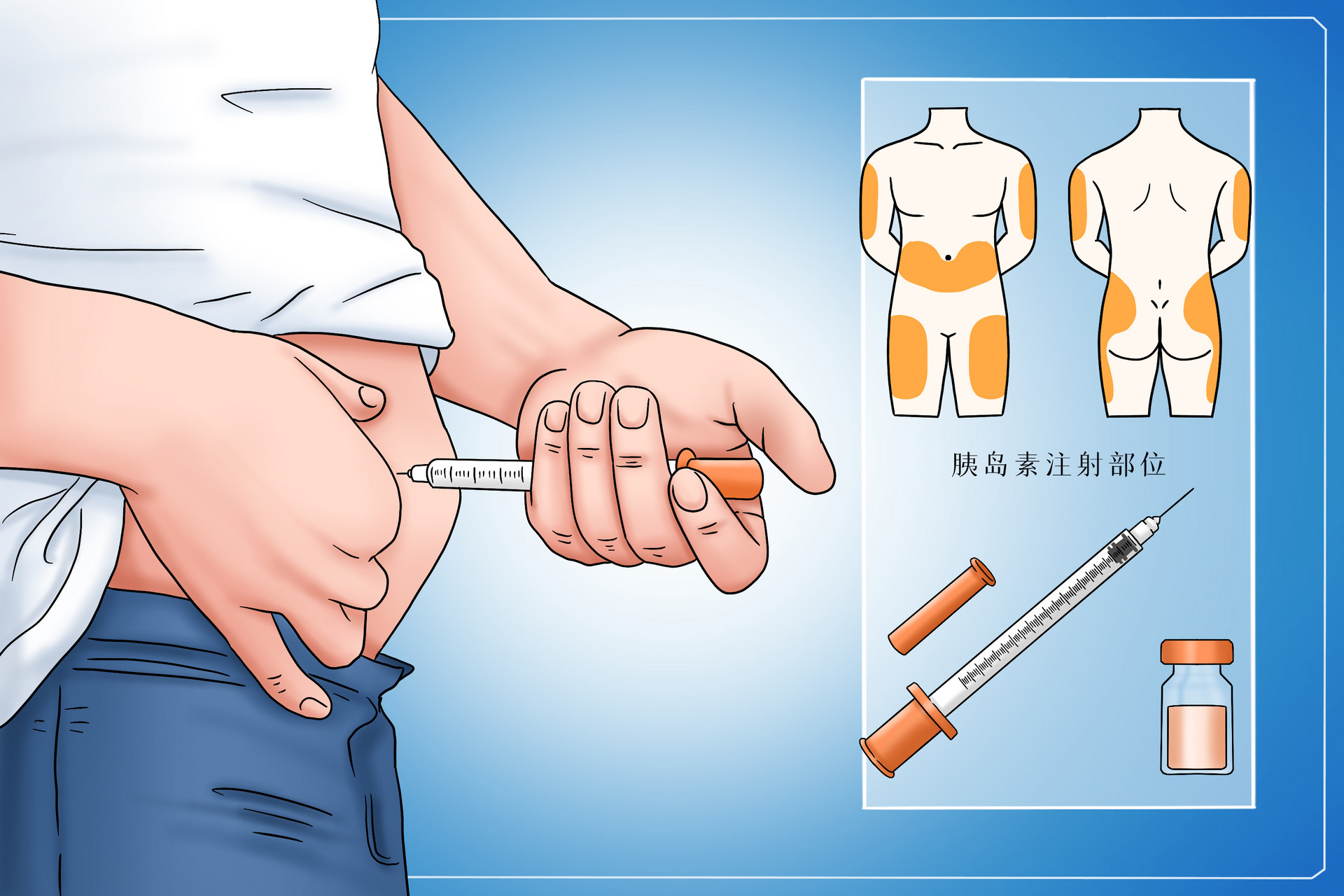 摄图网_401802909_糖尿病胰岛素治疗医疗插画(企业商用).jpg