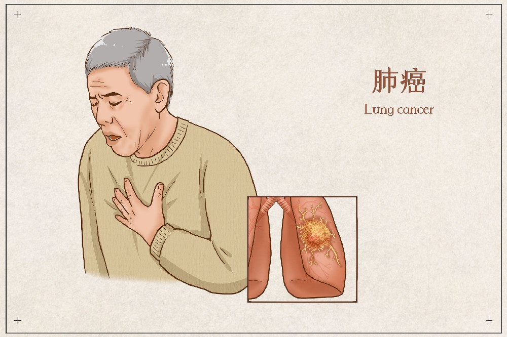 摄图网_401800683_banner_肺癌医疗插画（企业商用）(1).jpg
